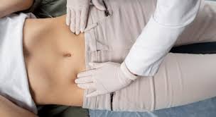 When to See a Chiropractor or Physiotherapist for Navel Displacement