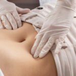 Navel displacement therapy