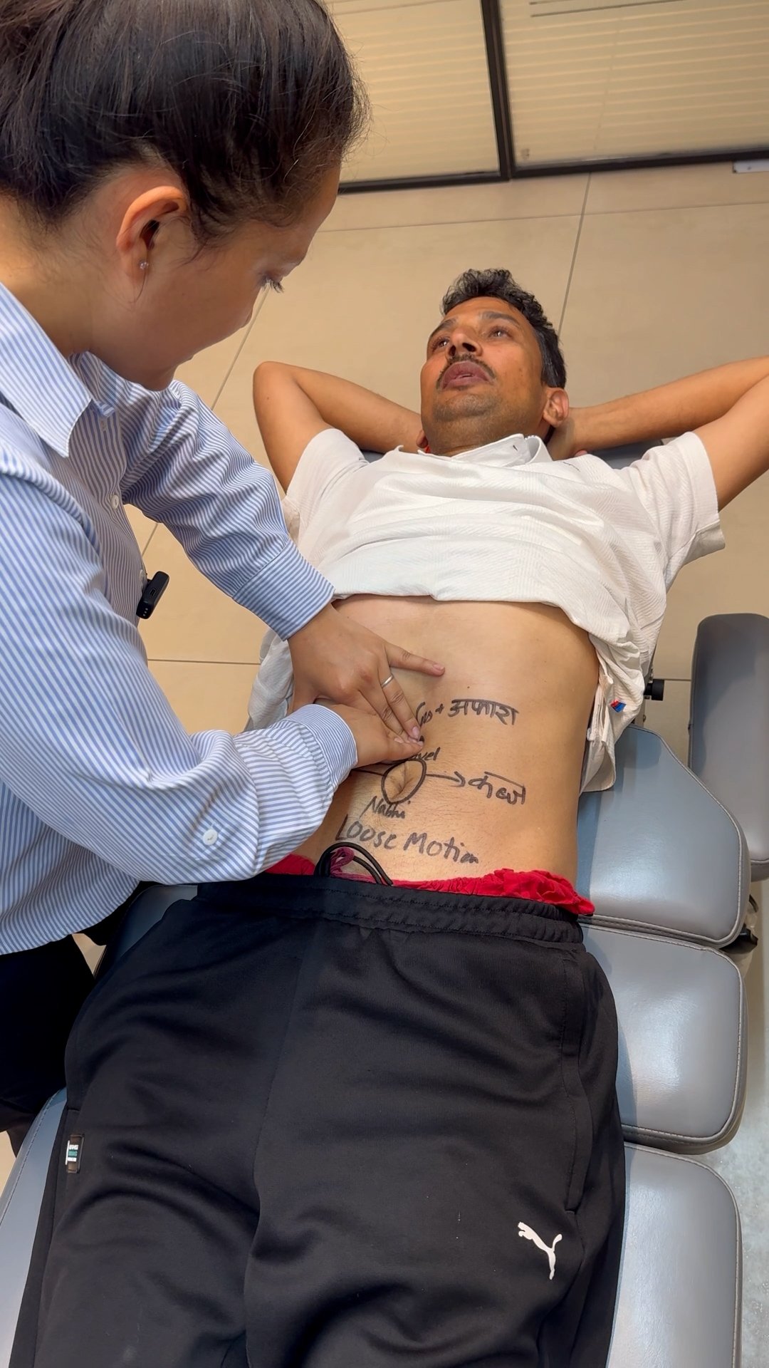 Navel Displacement